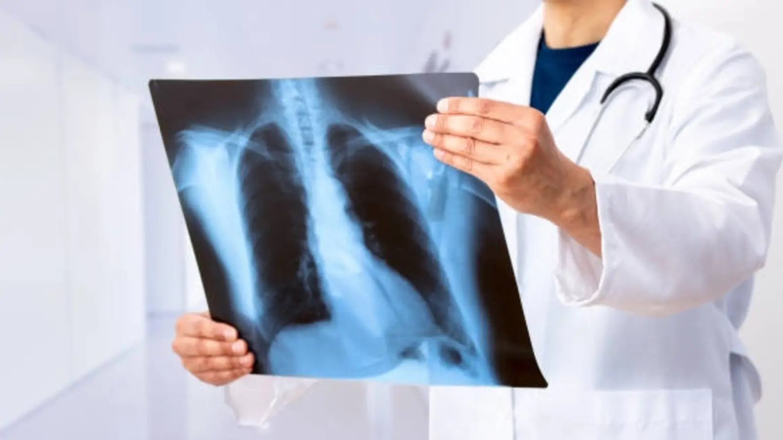 Tuberculoza în Vaslui: o creștere alarmantă a cazurilor în mediul rural